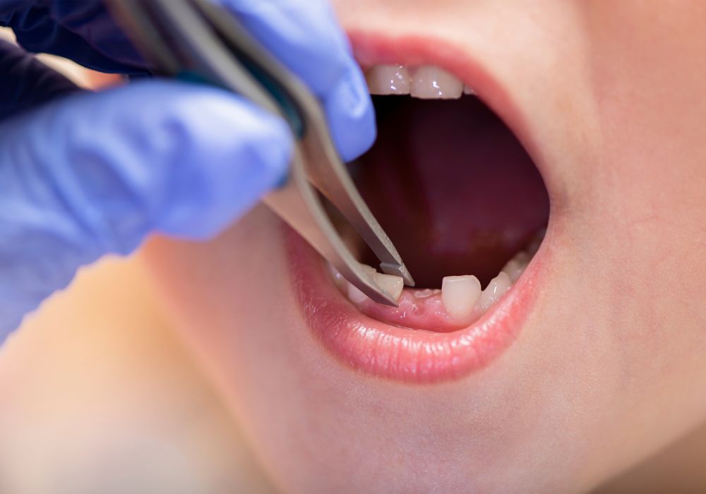 Dreams About Teeth Being Pulled Out: What's the Root of the Problem?