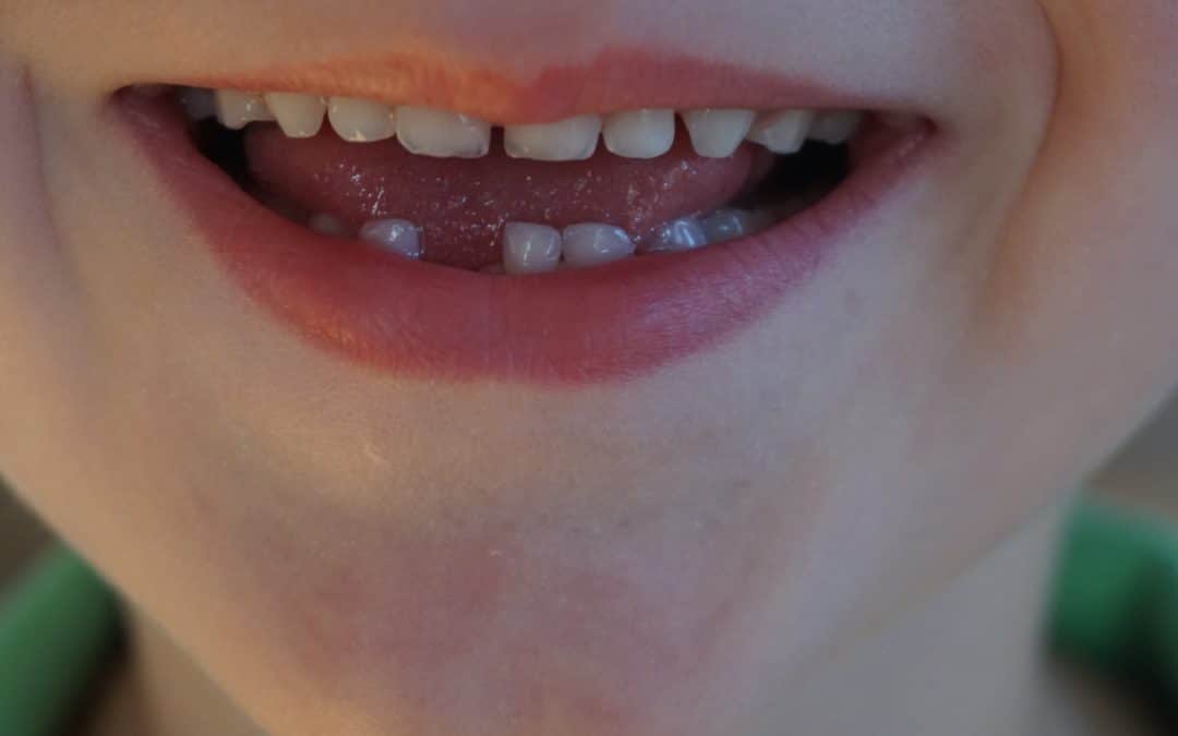 Exploring Dreams About Teeth Falling Out: What Do They Signify?